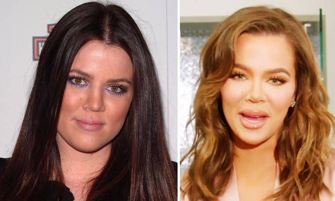 Kloe Kardashian Before And After