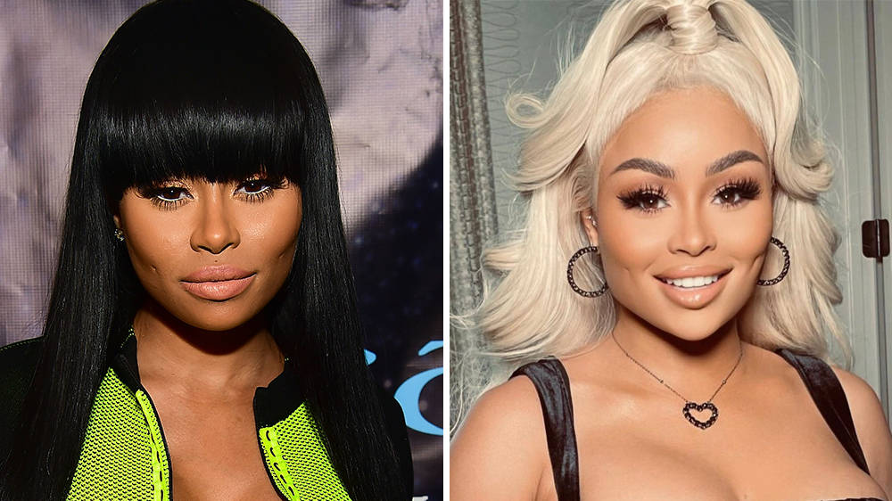 Blac Chyna Before & After