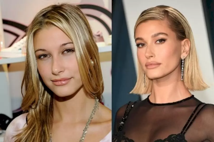hailey baldwin before after