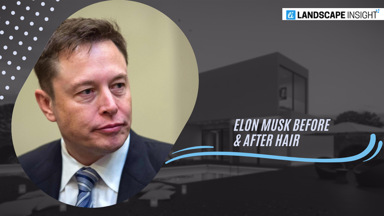 Elon Musk Before & After Hair