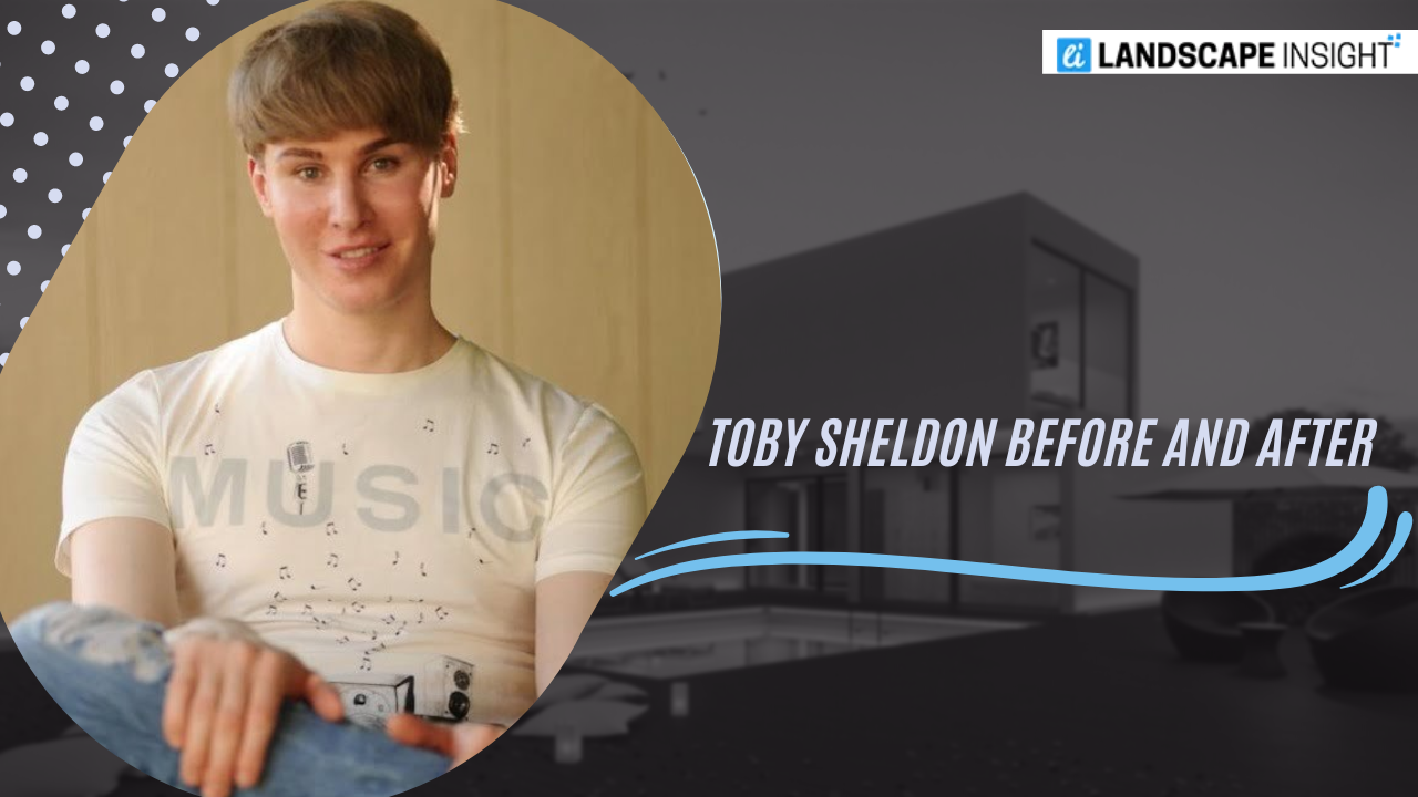 Toby Sheldon Before and After