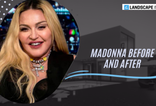 Madonna Before and After