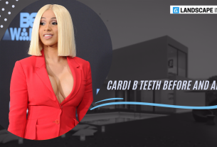 Cardi B Teeth Before and After