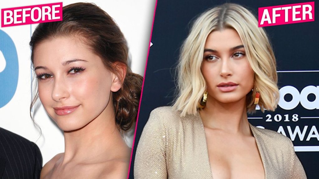 Hailey Bieber Before and After