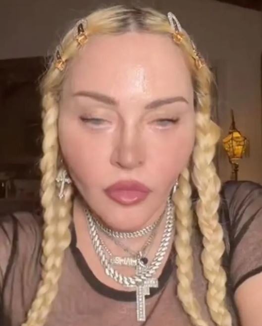 Madonna Transformation Photos Amid Plastic Surgery Rumors