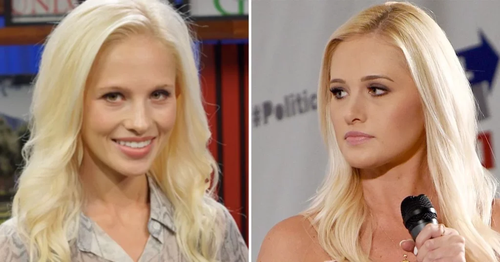 Tomi Lahren Before & After
