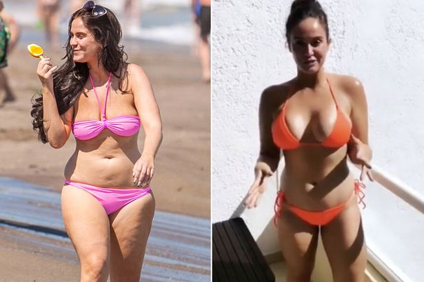 Vicky Pattison Before And After