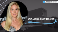 Heidi Montag Before and After
