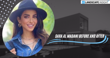 sara al madani before and after