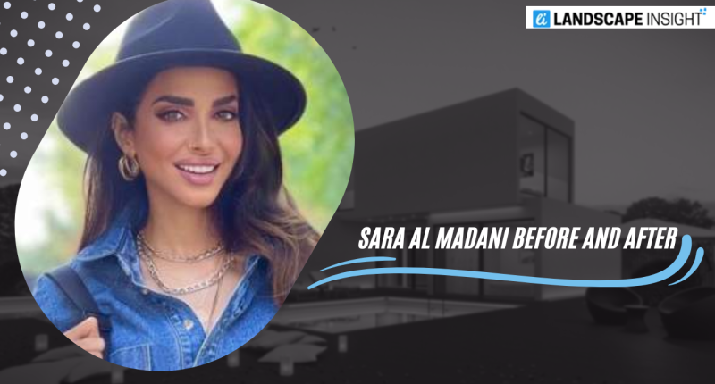 sara al madani before and after