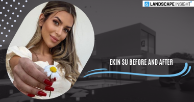 ekin su before and after