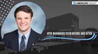 otto warmbier teeth before and after