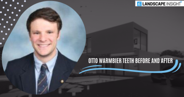 otto warmbier teeth before and after