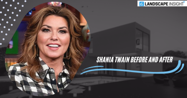 shania twain before and after