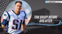 tom brady before and after
