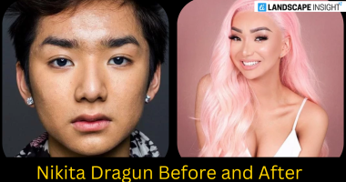 nikita dragun before and after