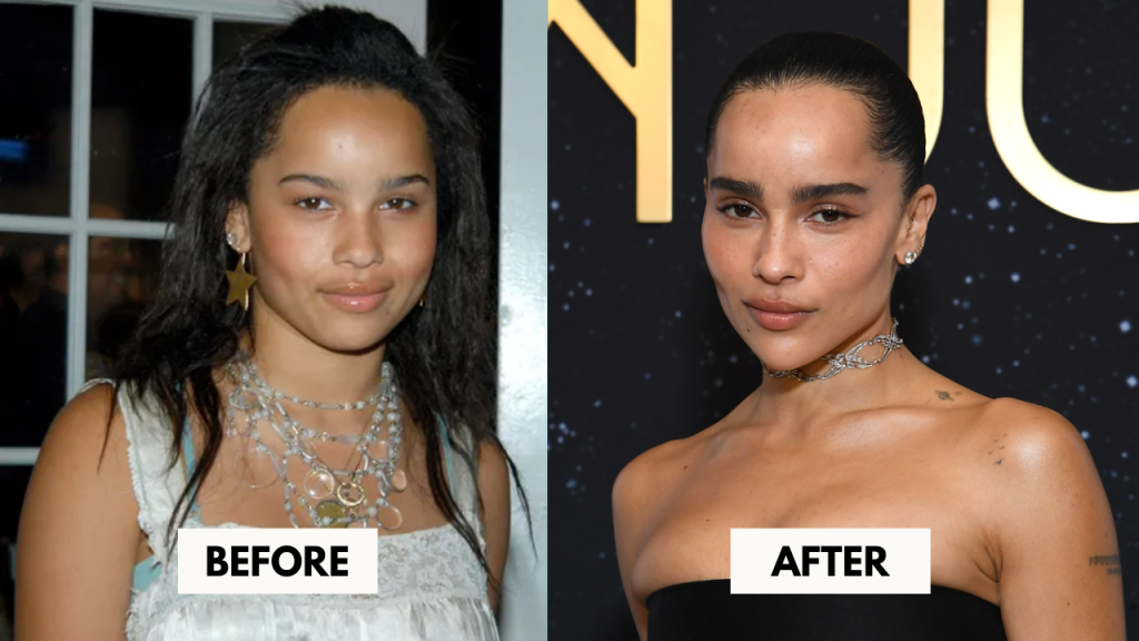 Zoe Kravitz Before and After