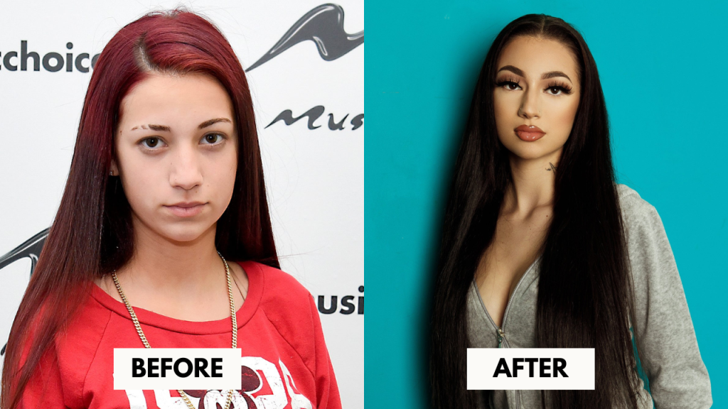 Bhad Bhabie Before and After