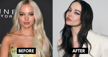 Dove Cameron Before and After