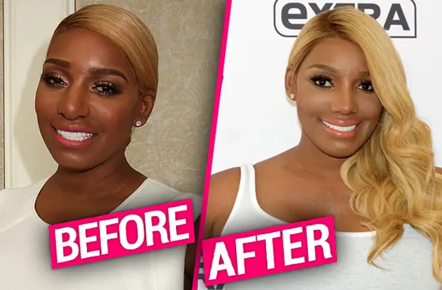 Nene leaks before and after surgery