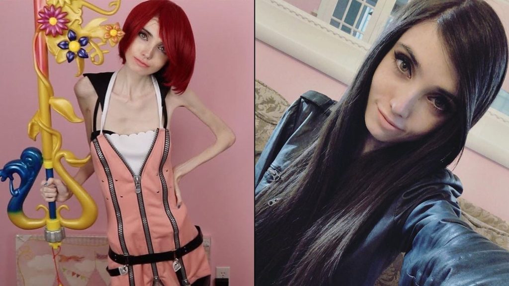 Eugenia Cooney's transformation through anorexia nervosa.