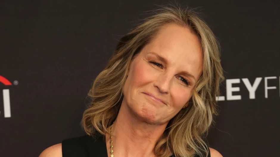 Did Helen Hunt Have Plastic Surgery?