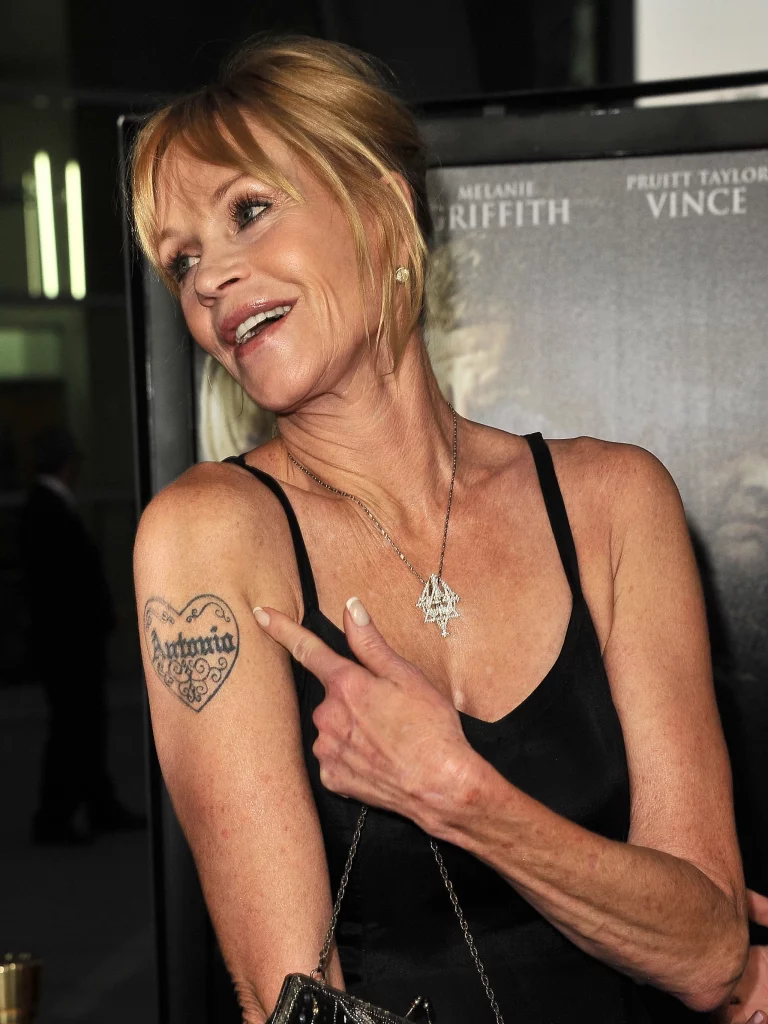 Melanie Griffith's Tattoo Removal