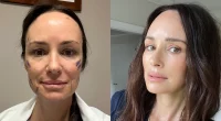 catt sadler before and after