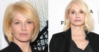 ellen barkin plastic surgery