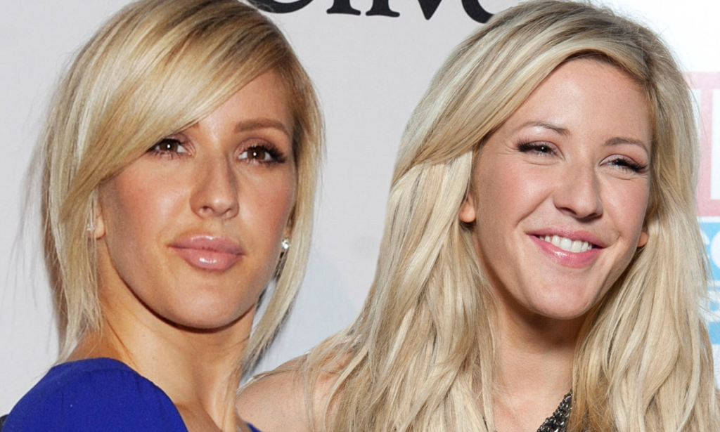 ellie goulding plastic surgery