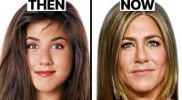 jennifer aniston plastic surgery