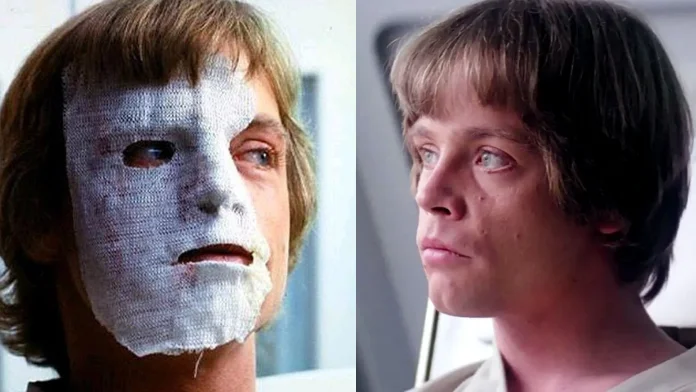 Mark Hamill Opens Up About His Facial Injuries